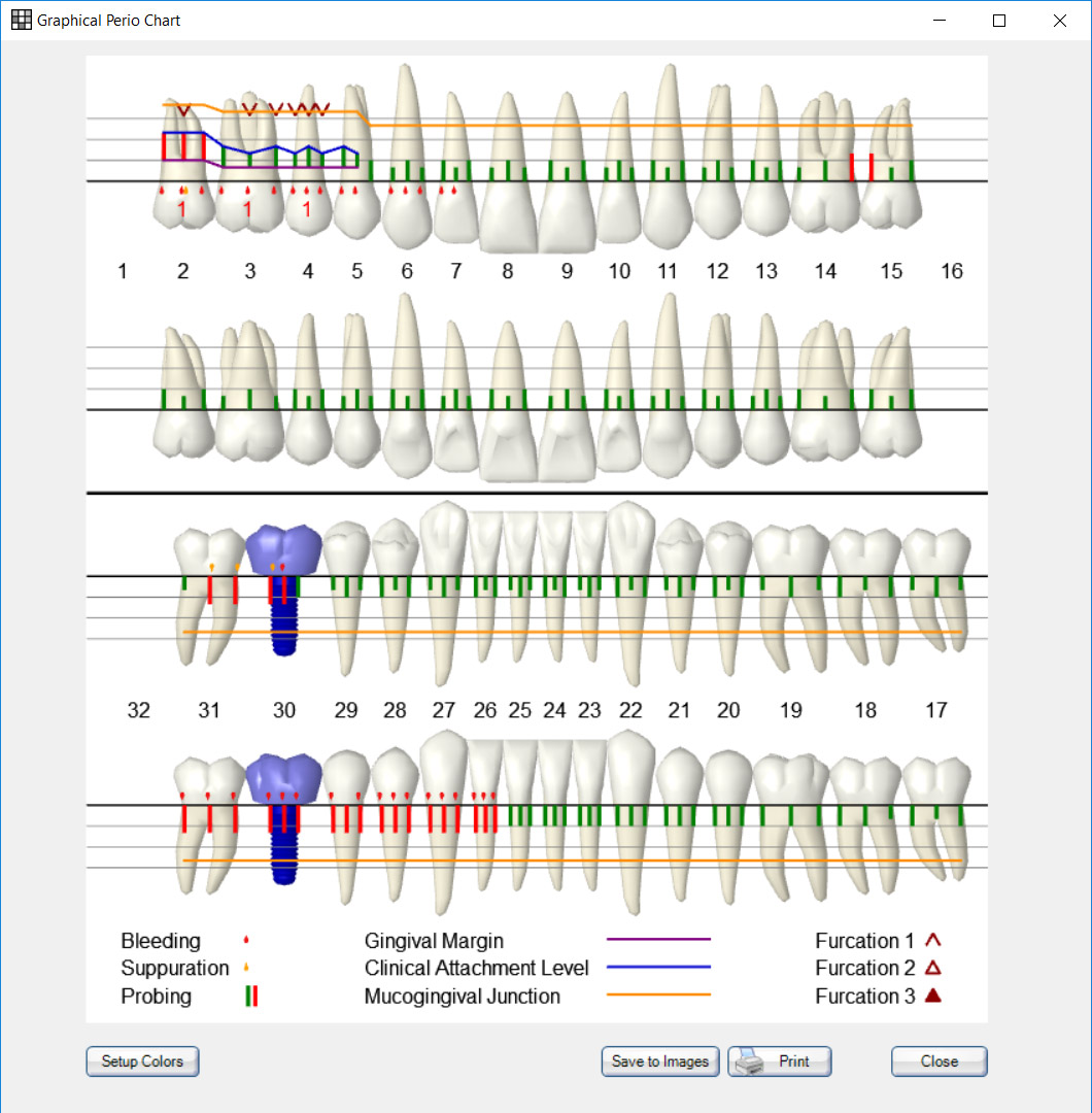 How To Do Periodontal Charting Best Picture Of Chart Anyimage Org